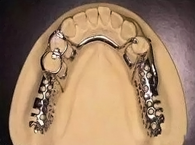SDT-ET03 Co-Base Dental Alloy
